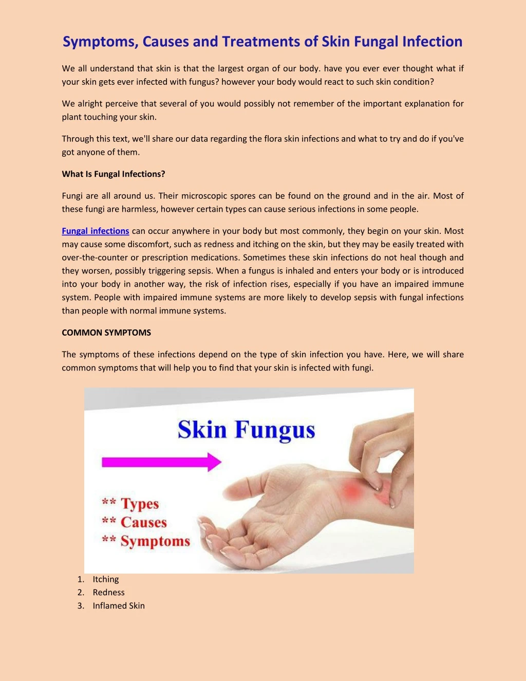 symptoms causes and treatments of skin fungal