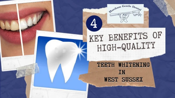 4 Key Benefits Of High-Quality Teeth Whitening In West Sussex