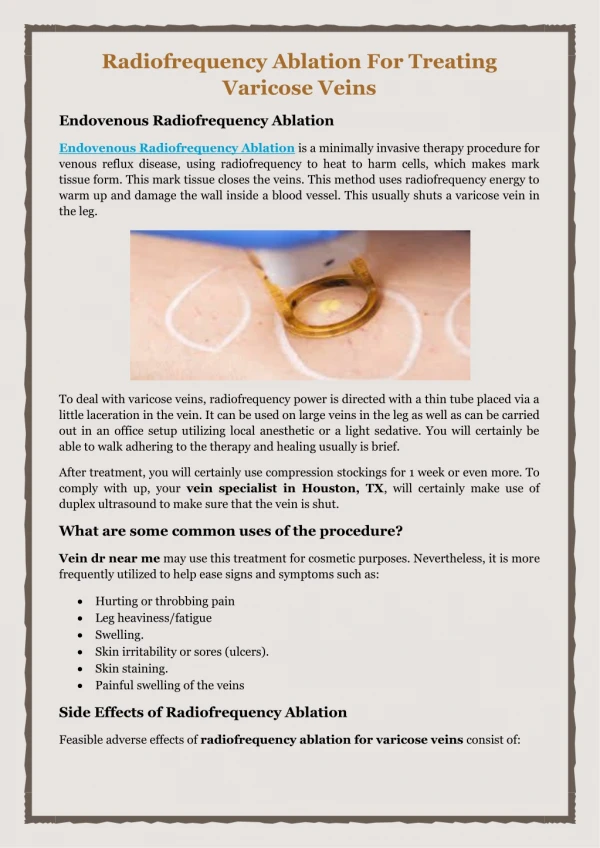 radiofrequency ablation for treating varicose