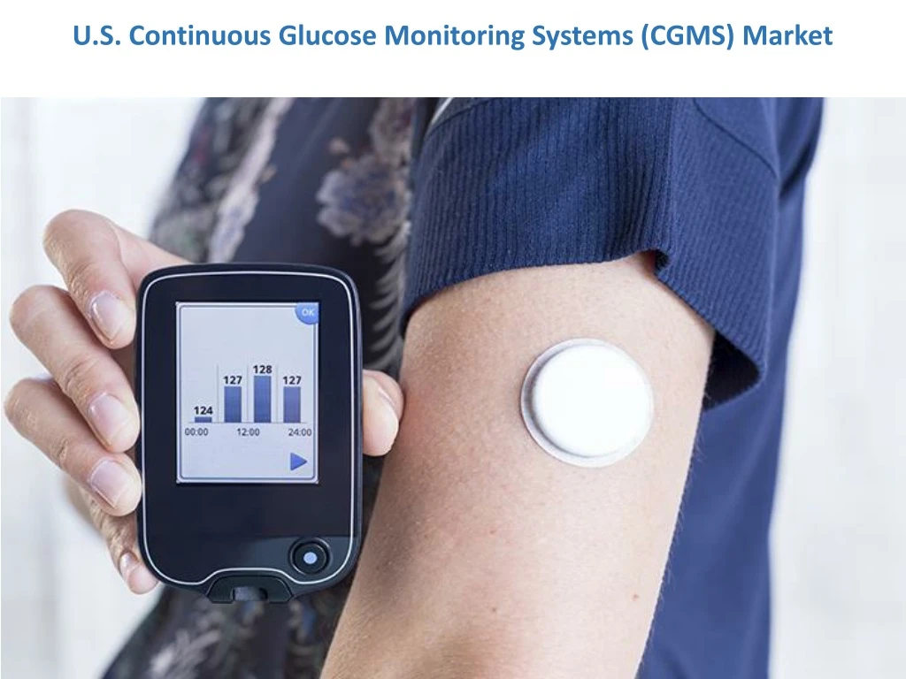 u s continuous glucose monitoring systems cgms