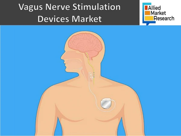 Vagus Nerve Stimulation Devices Market