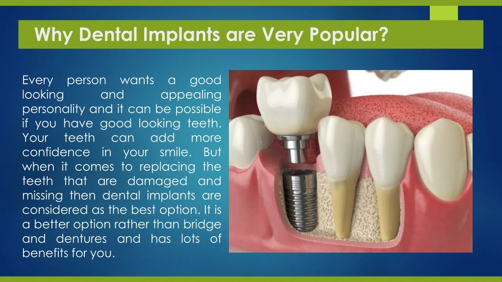 why dental implants are very popular
