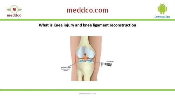 Knee Collateral Ligament Reconstruction
