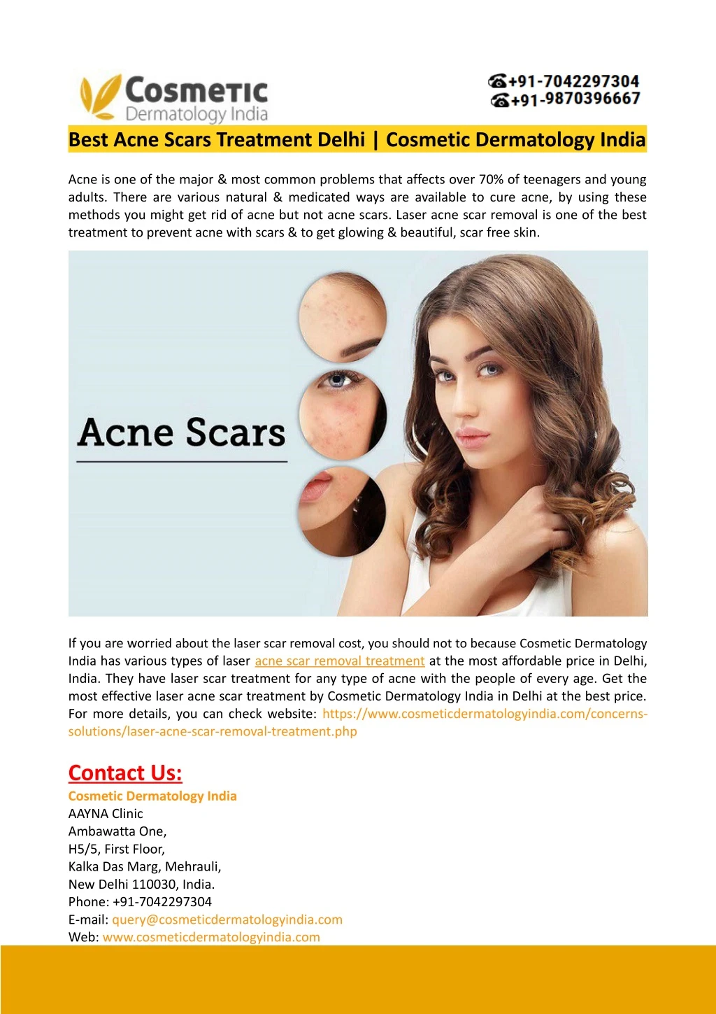 PPT - Best Acne Scars Treatment Delhi-Cosmetic Dermatology India ...