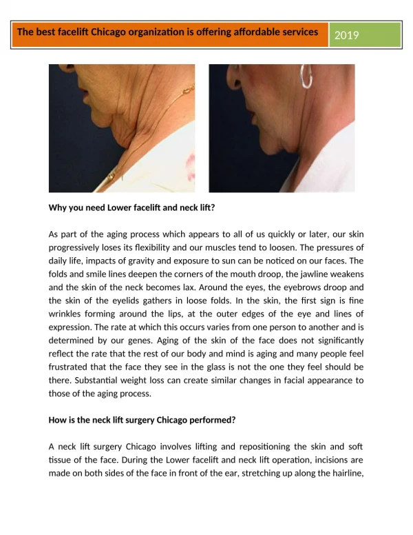 Best facelift surgeons are offering affordable facelift services.