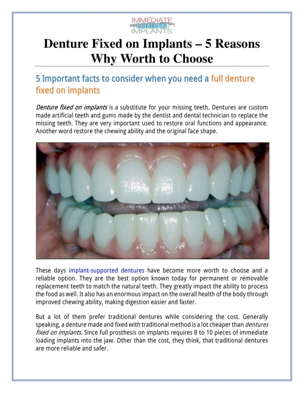 Denture Fixed on Implants – 5 Reasons Why Worth to Choose