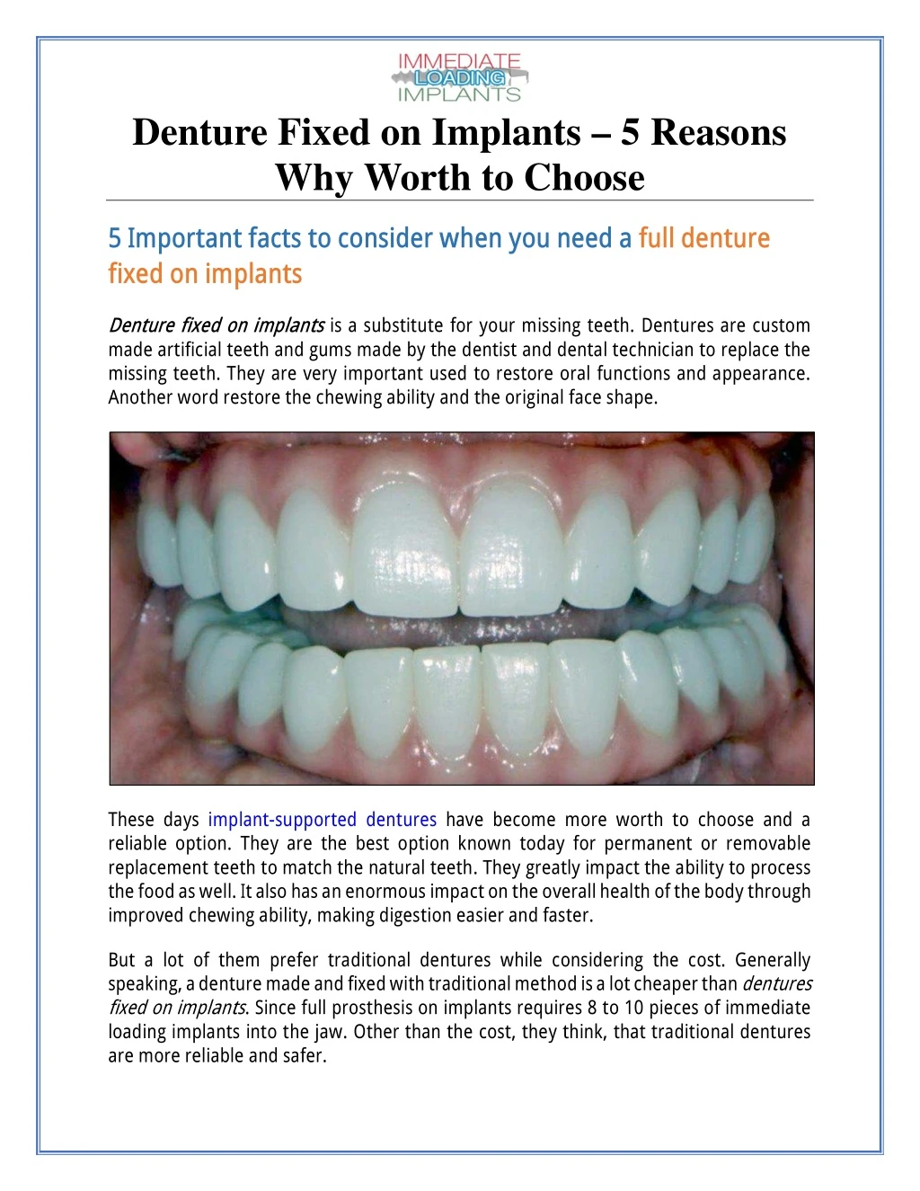 denture fixed on implants 5 reasons why worth