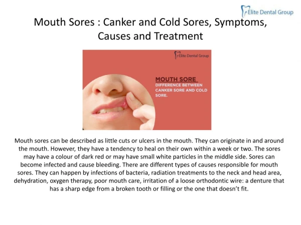 MOUTH SORES : CANKER AND COLD SORES, SYMPTOMS, CAUSES AND TREATMENT