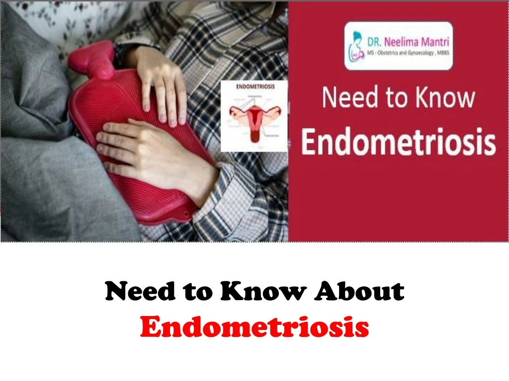 need to know about endometriosis