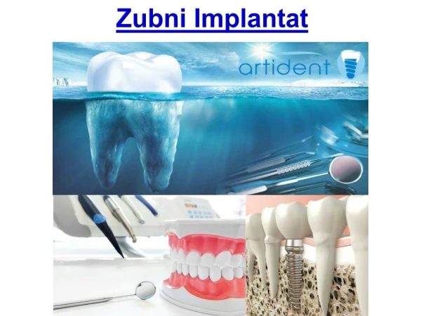 zubni implantat