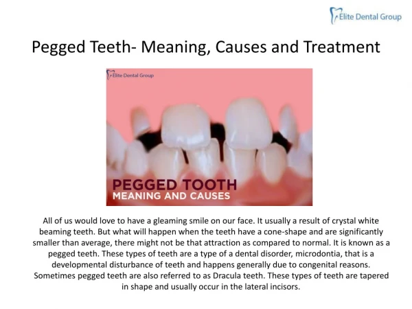 PEGGED TEETH- MEANING, CAUSES AND TREATMENT