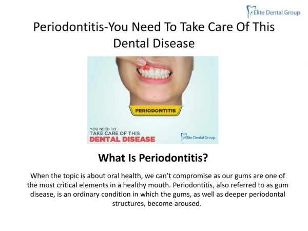 PERIODONTITIS-YOU NEED TO TAKE CARE OF THIS DENTAL DISEASE