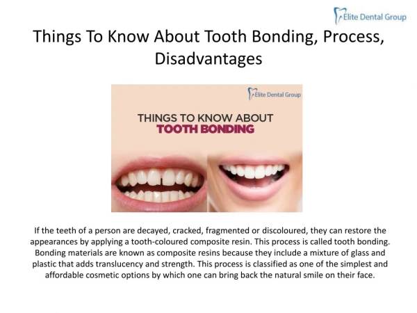 Things To Know About Tooth Bonding, Process, Disadvantages