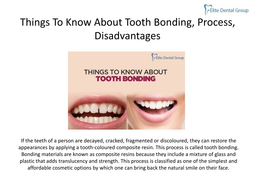 things to know about tooth bonding process disadvantages