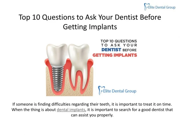 Top 10 Questions to Ask Your Dentist Before Getting Implants