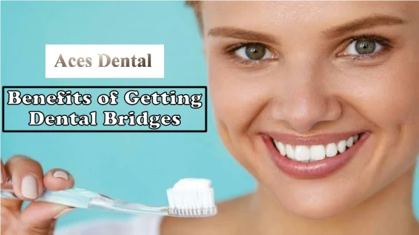 Benefits of Getting Dental Bridges