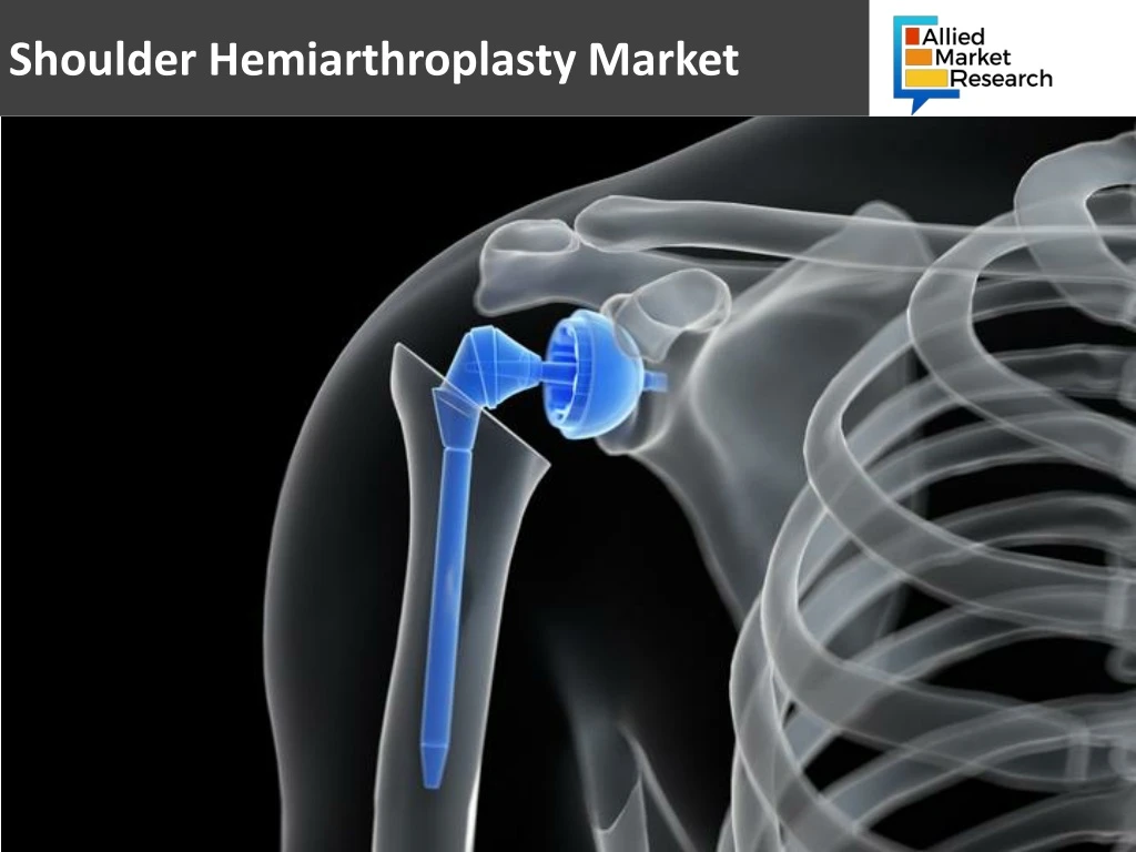 shoulder hemiarthroplasty market