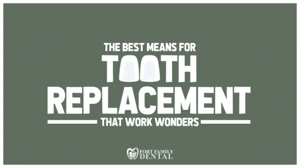 The Best Means for Tooth Replacement That Work Wonders