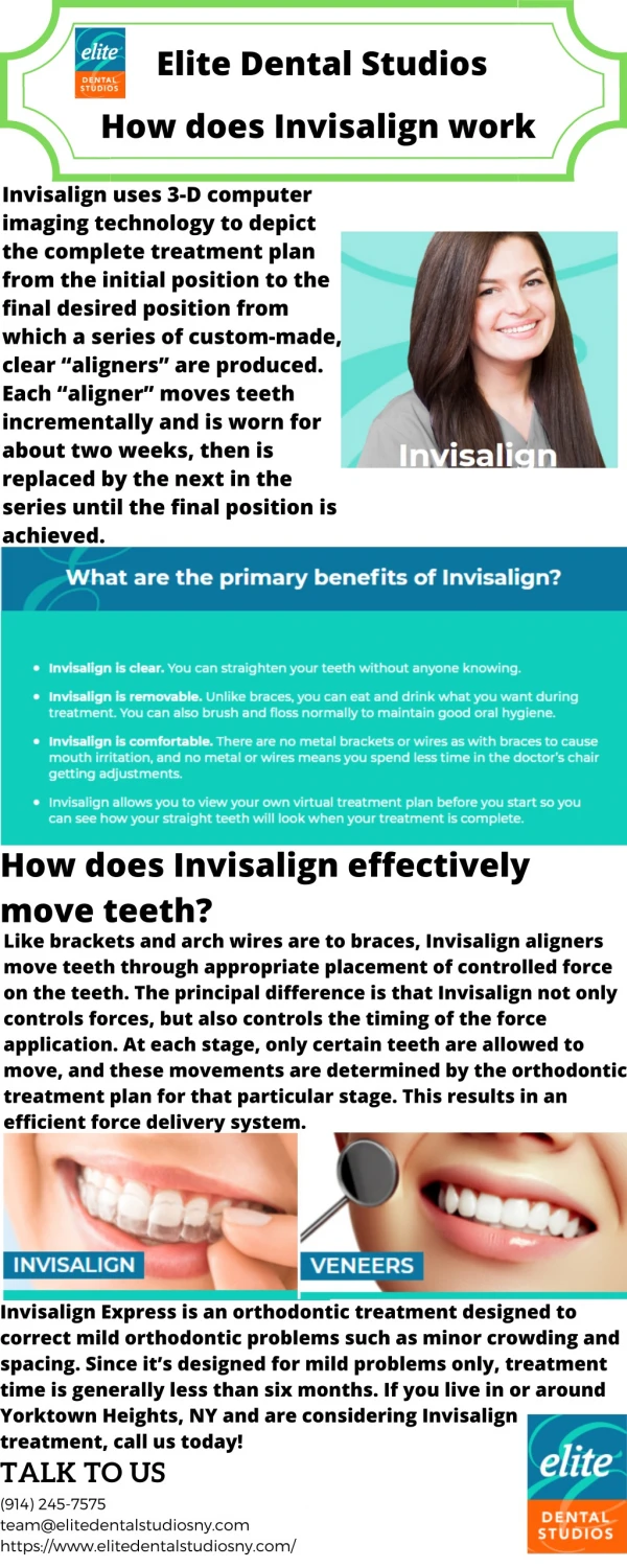 How does Invisalign Work?