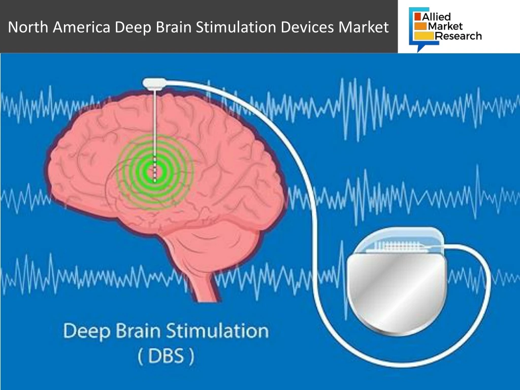 north america deep brain stimulation devices