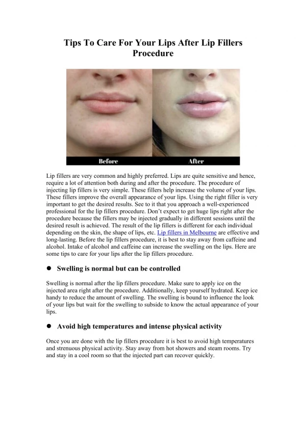 Tips To Care For Your Lips After Lip Fillers Procedure