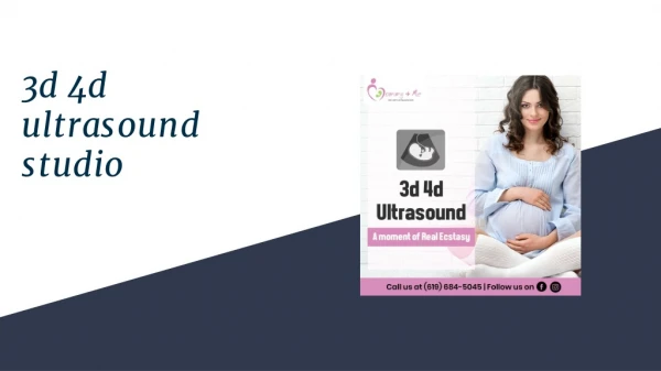 3D 4D ultrasounds san diego