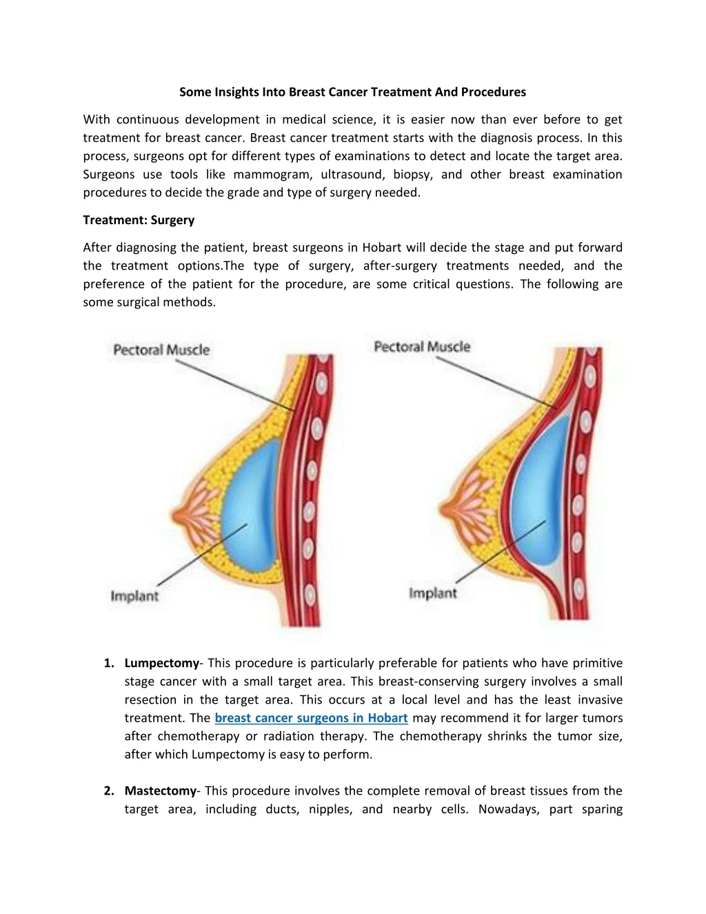 some insights into breast cancer treatment