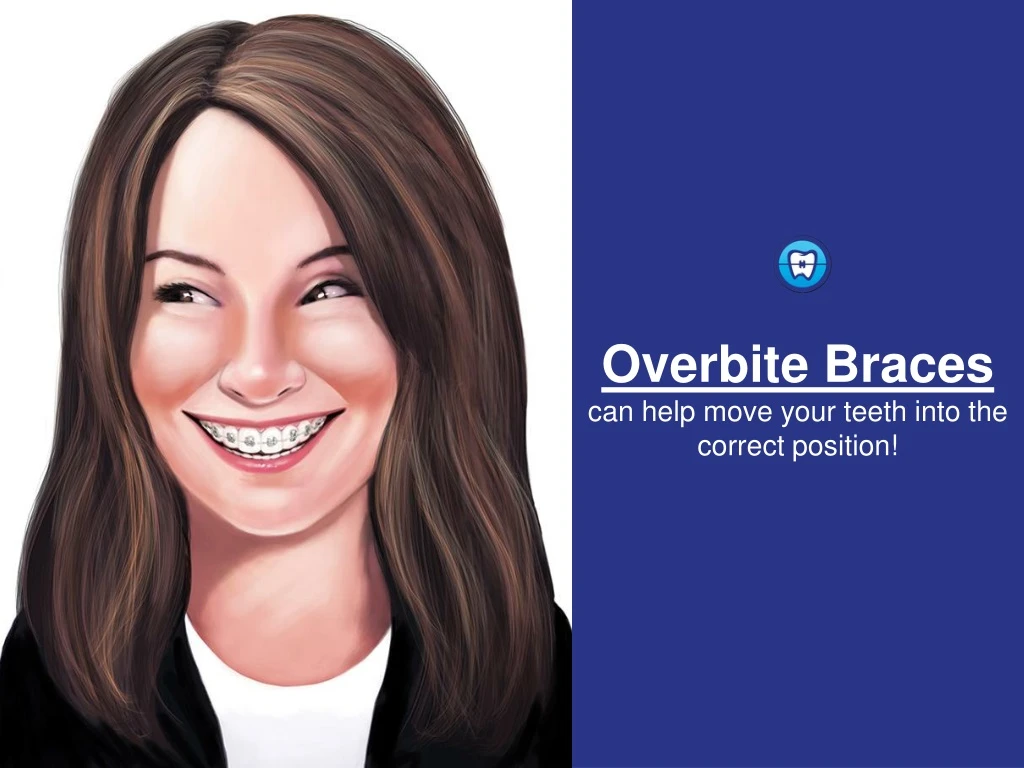 overbite braces can help move your teeth into the correct position