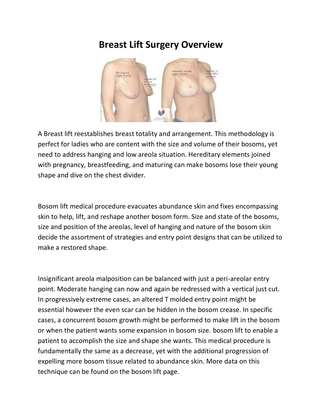 breast lift surgery overview