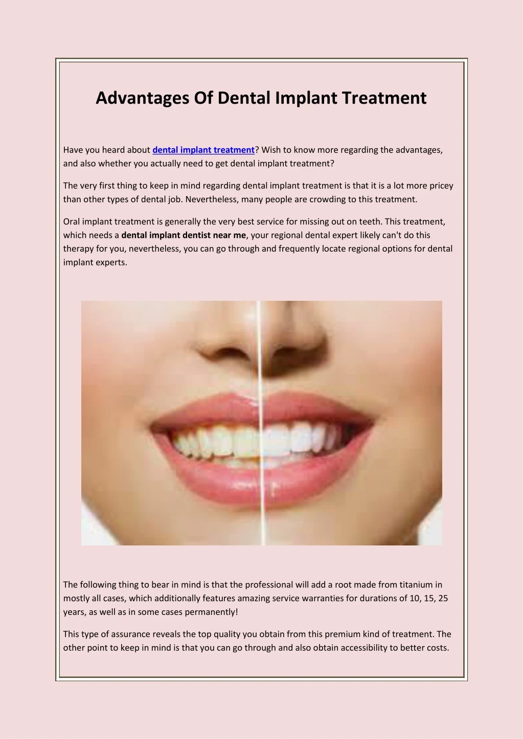 advantages of dental implant treatment