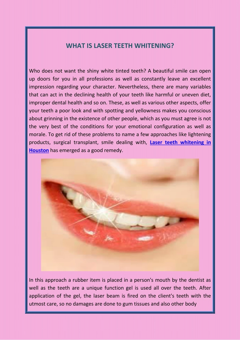 what is laser teeth whitening