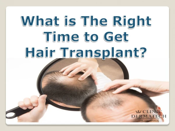 What is the right time to get Hair Transplant?