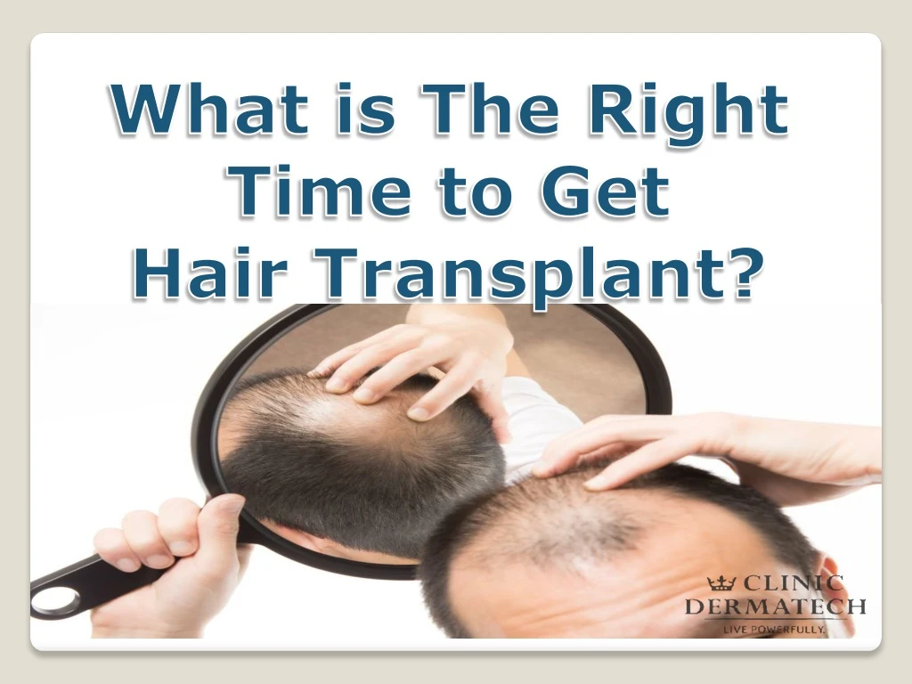 what is the right time to get hair transplant