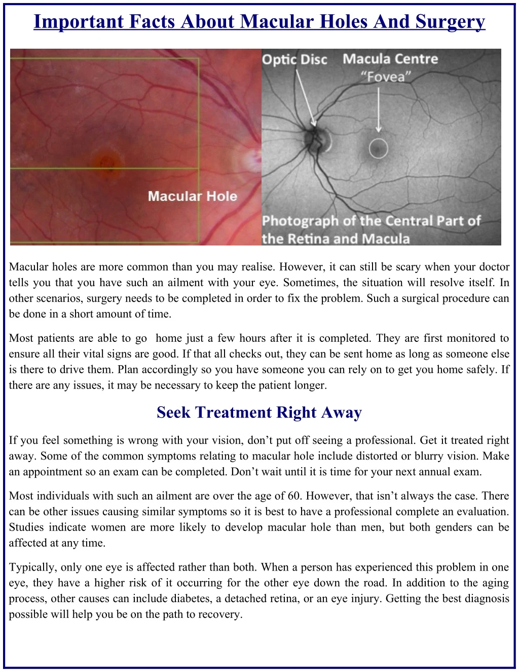 important facts about macular holes and surgery