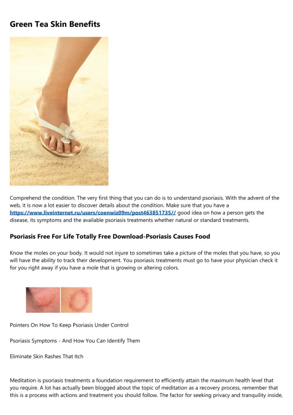 How Do You Know If You Have Psoriasis - An Expedition Of The Skin Condition