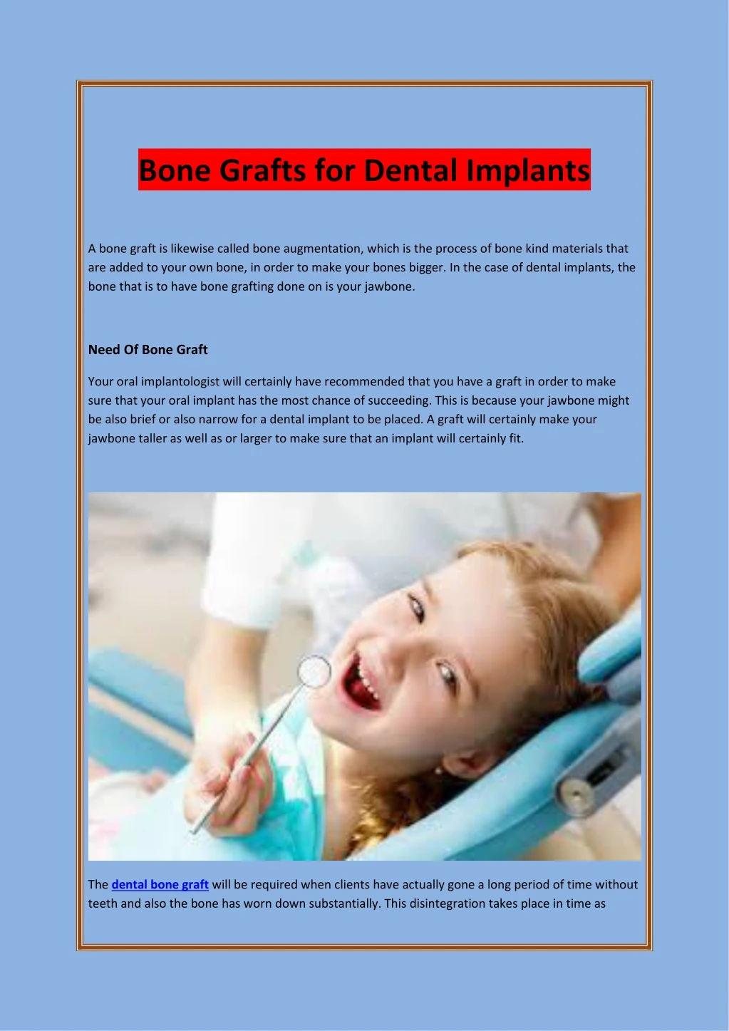 bone grafts for dental implants