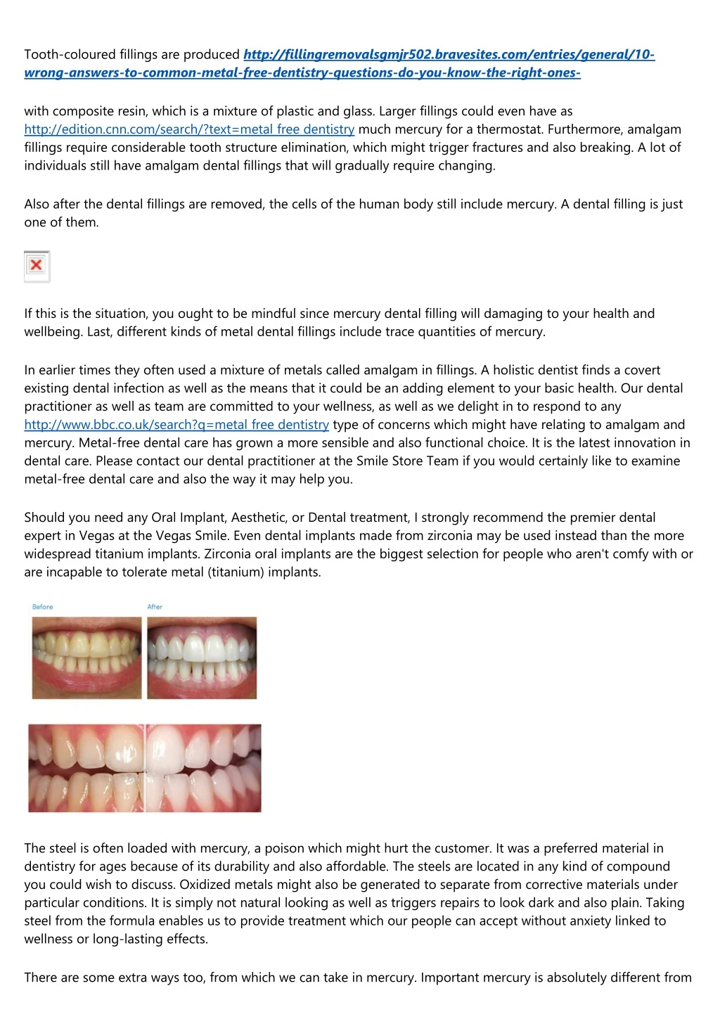 tooth coloured fillings are produced http