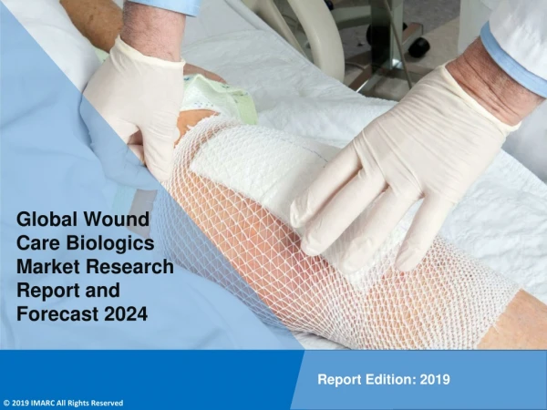 Wound Care Biologics Market PDF 2019-2024: Global Size, Share, Trends, Analysis & Research Report