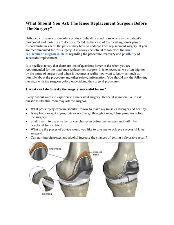 What Should You Ask The Knee Replacement Surgeon Before The Surgery?