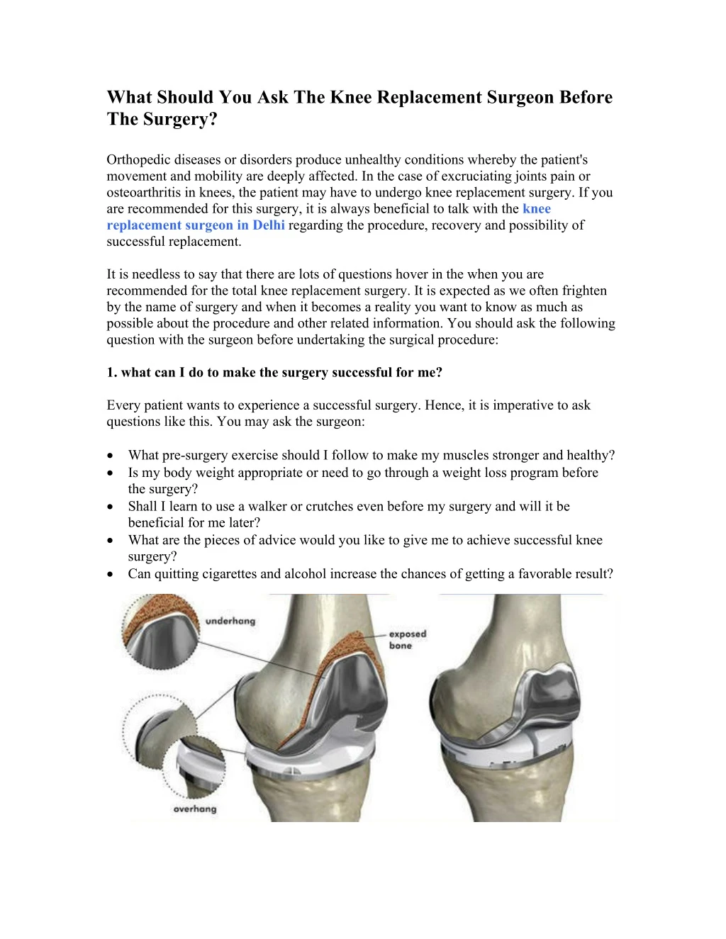 what should you ask the knee replacement surgeon