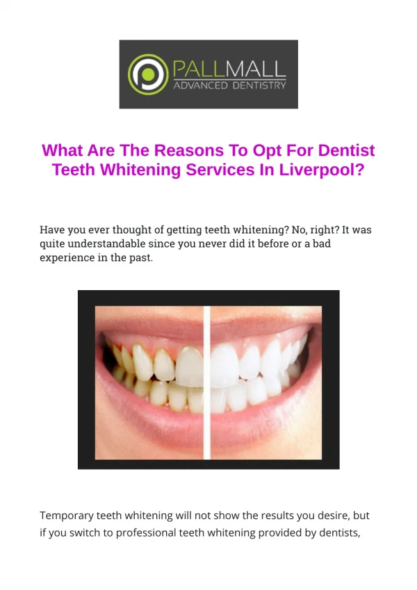 What Are The Reasons To Opt For Dentist Teeth Whitening Services In Liverpool?