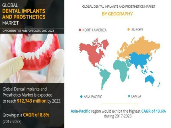 Dental Implants and Prosthetics Market Projected to Expand at a CAGR of 8.8% from 2017 to 2023