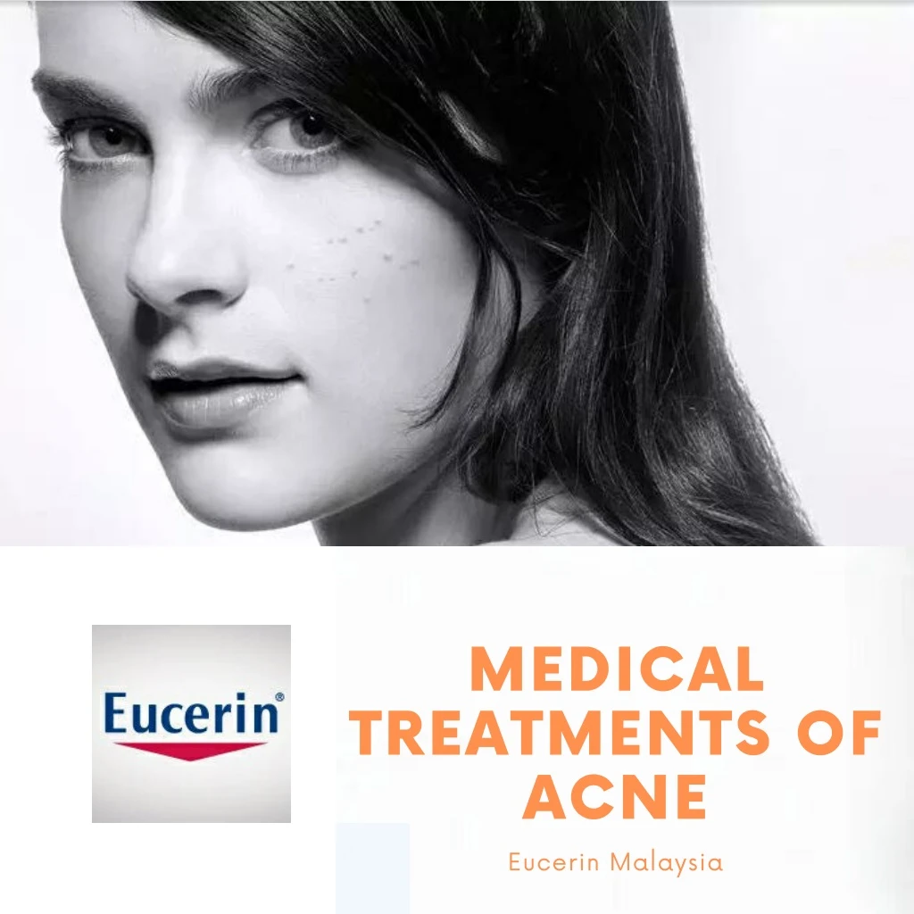 medical treatments of acne