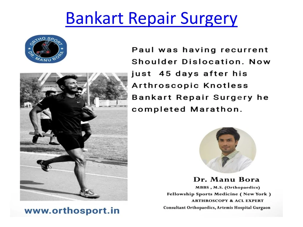bankart repair surgery