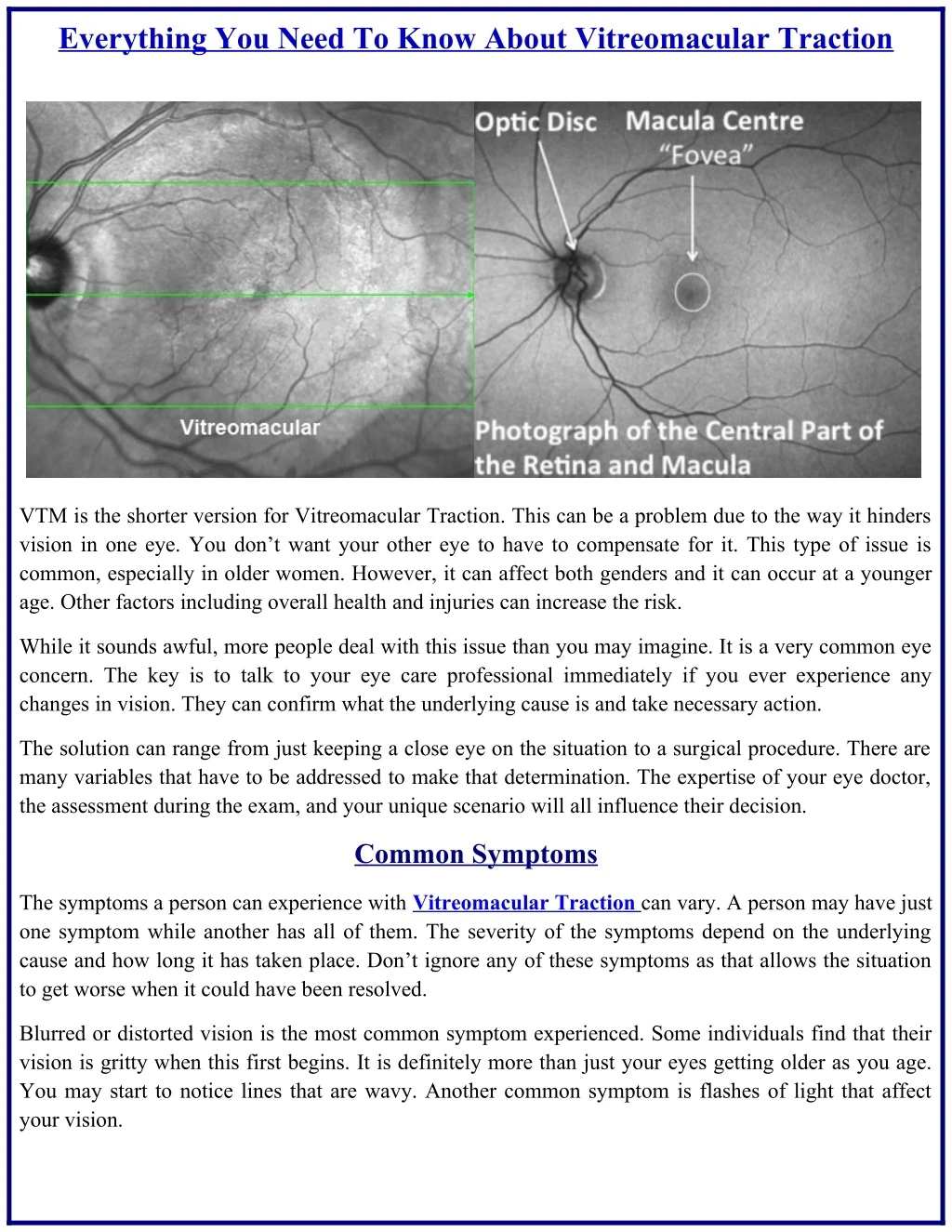 everything you need to know about vitreomacular