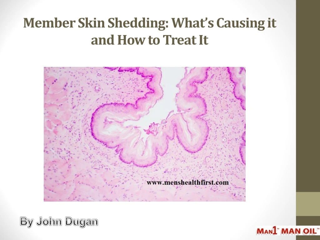 member skin shedding what s causing it and how to treat it