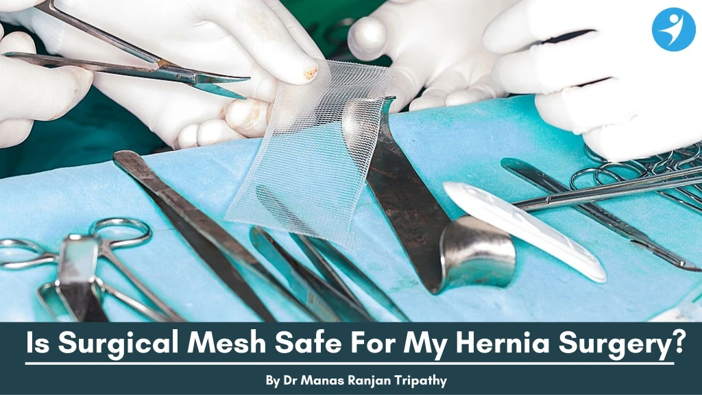 is surgical mesh safe for my hernia surgery