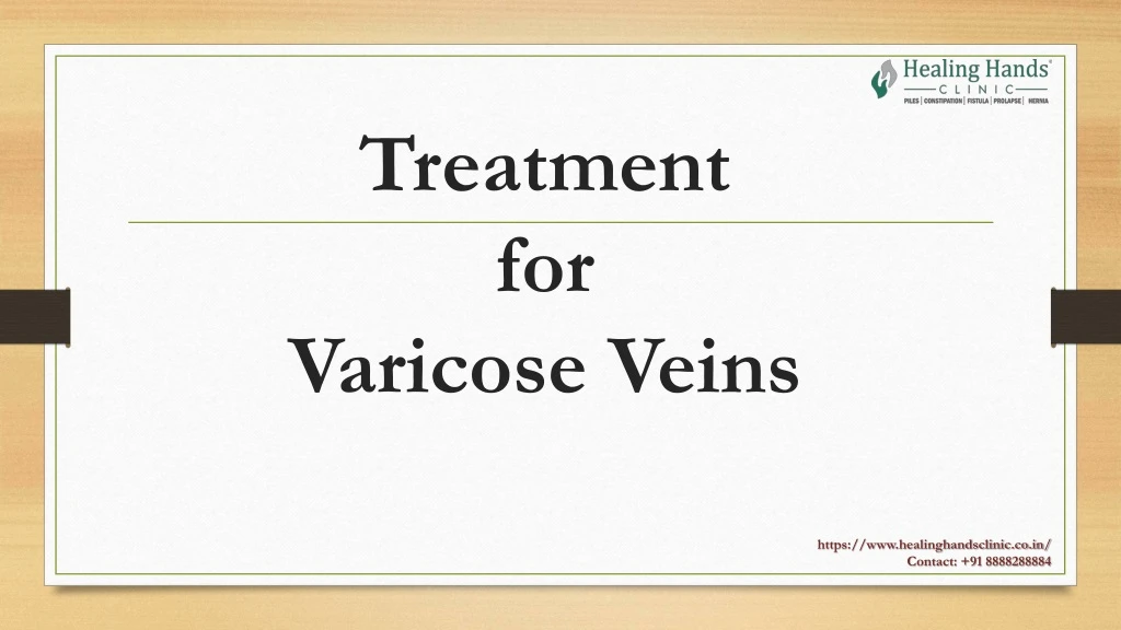 treatment for varicose veins