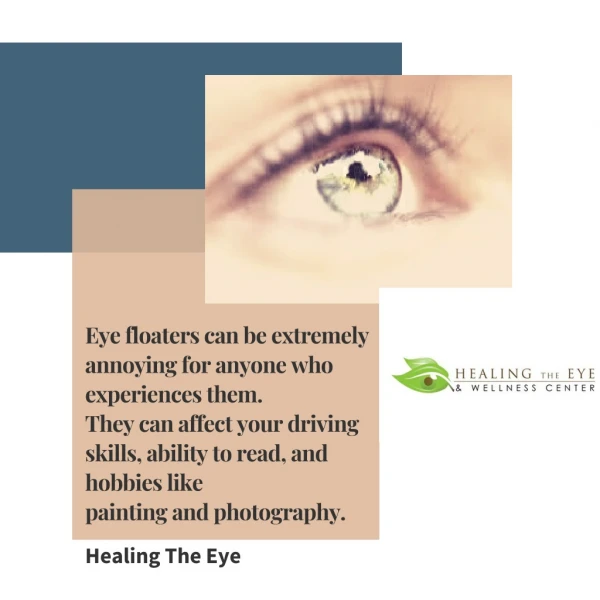 Facts On eye Floaters