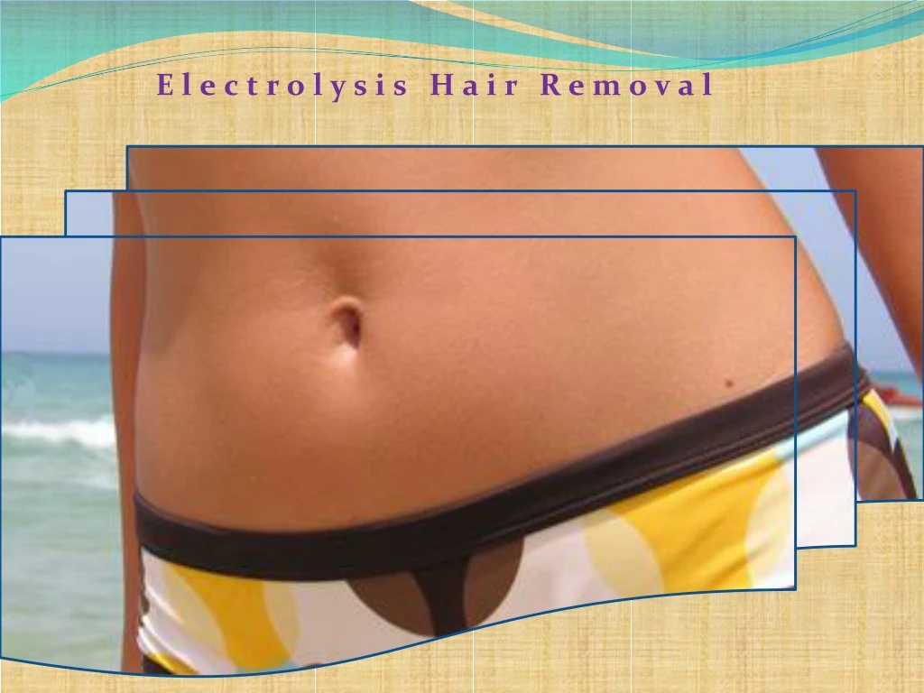 electrolysis hair removal